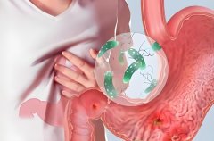 重庆铭博医院，如何检查胃溃疡胃炎?