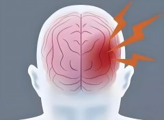 实时公开：重庆治疗脑梗的医院排行-总榜公开-重庆专业治疗脑梗医院排名公布